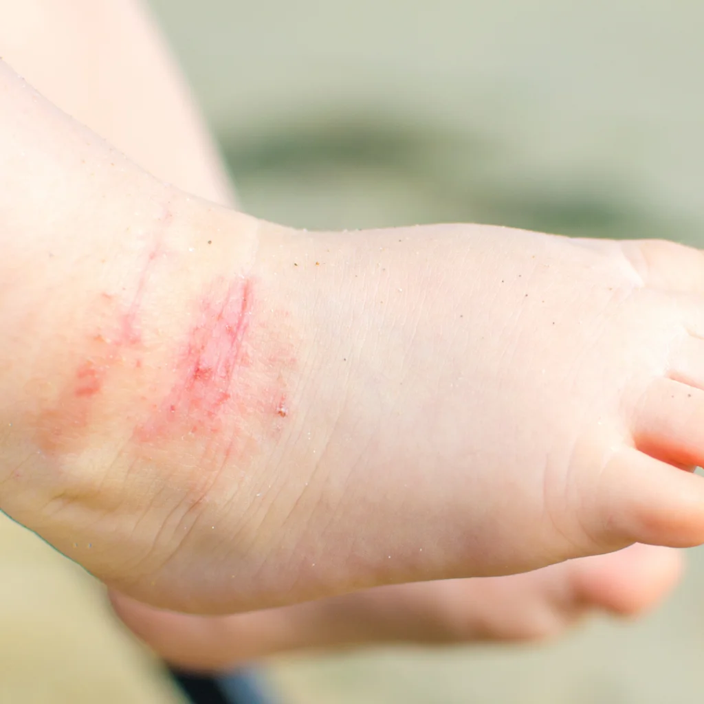 hundefutter arthrose ARTHRO Plus – Natürliches Kräuterpulver zur ernährungsphysiologischen