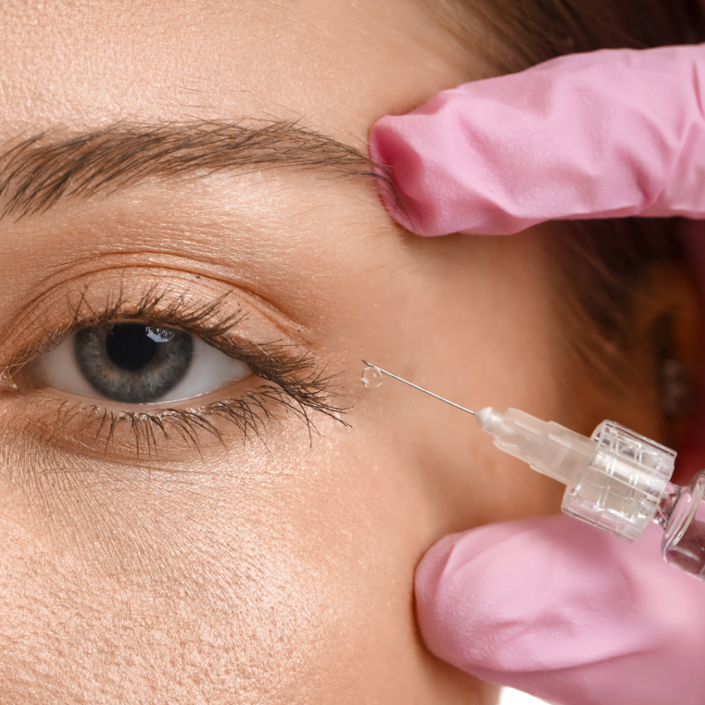 aplikacija hijaluronskih filera u područije oko očiju jer su hijaluronski fileri izuzetno efikasni u postizanju mladalačkog izgleda