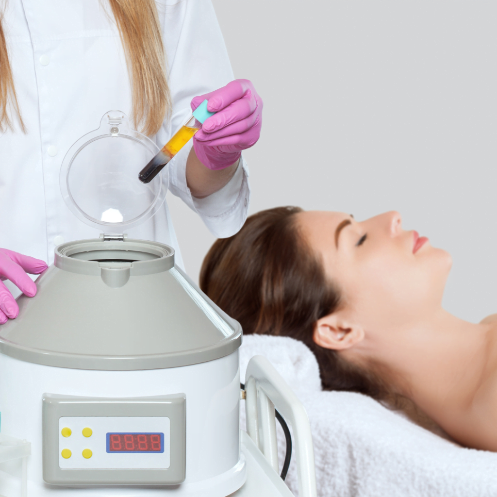 prp tretman za lečenje ožiljaka od akni: lekarka drži epruvetu plazme bogate trombocitima, dok pacijentkinja leži, spremna za aplikaciju