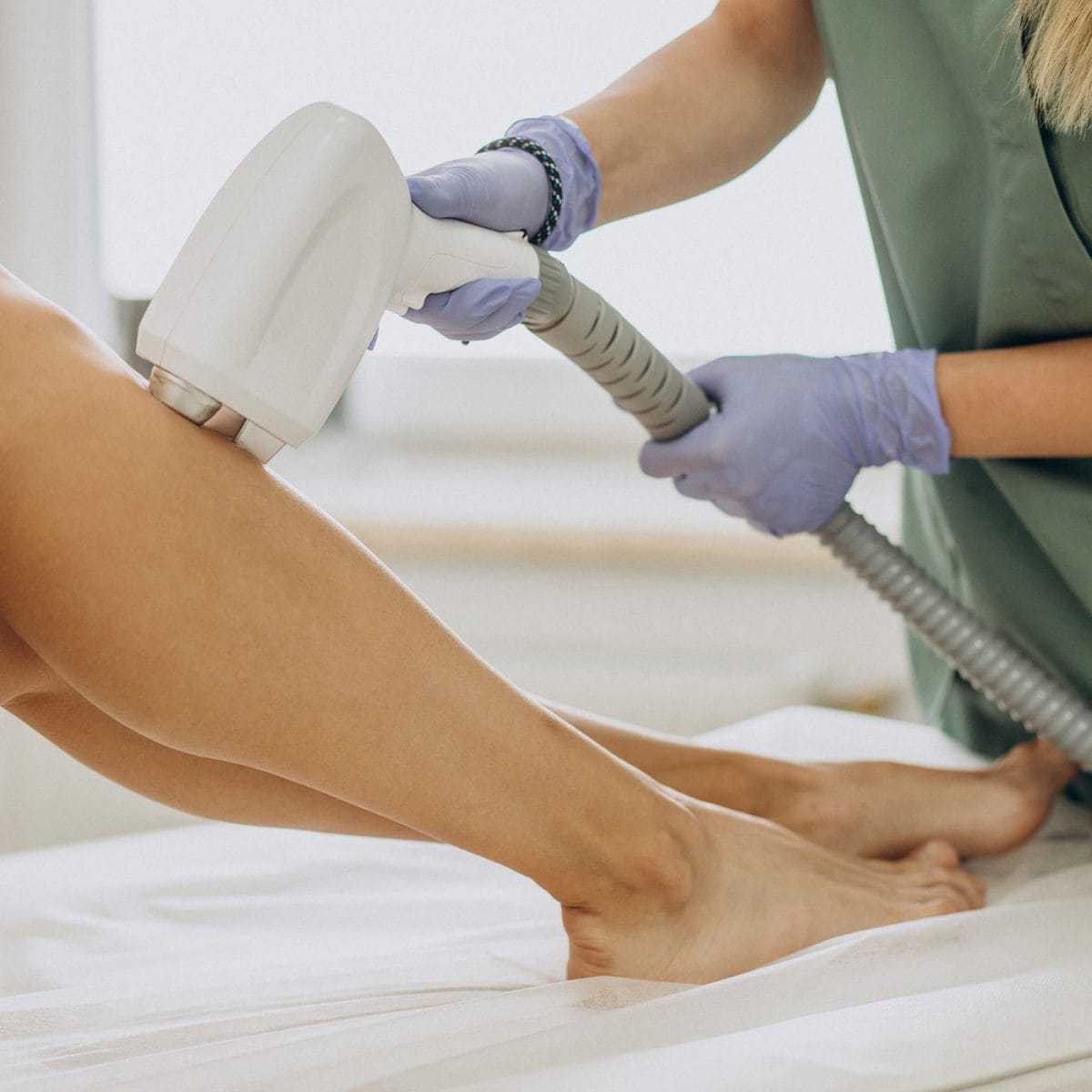 laserska epilacija nogu u dermatološkoj ordinaciji diva medical u beogradu