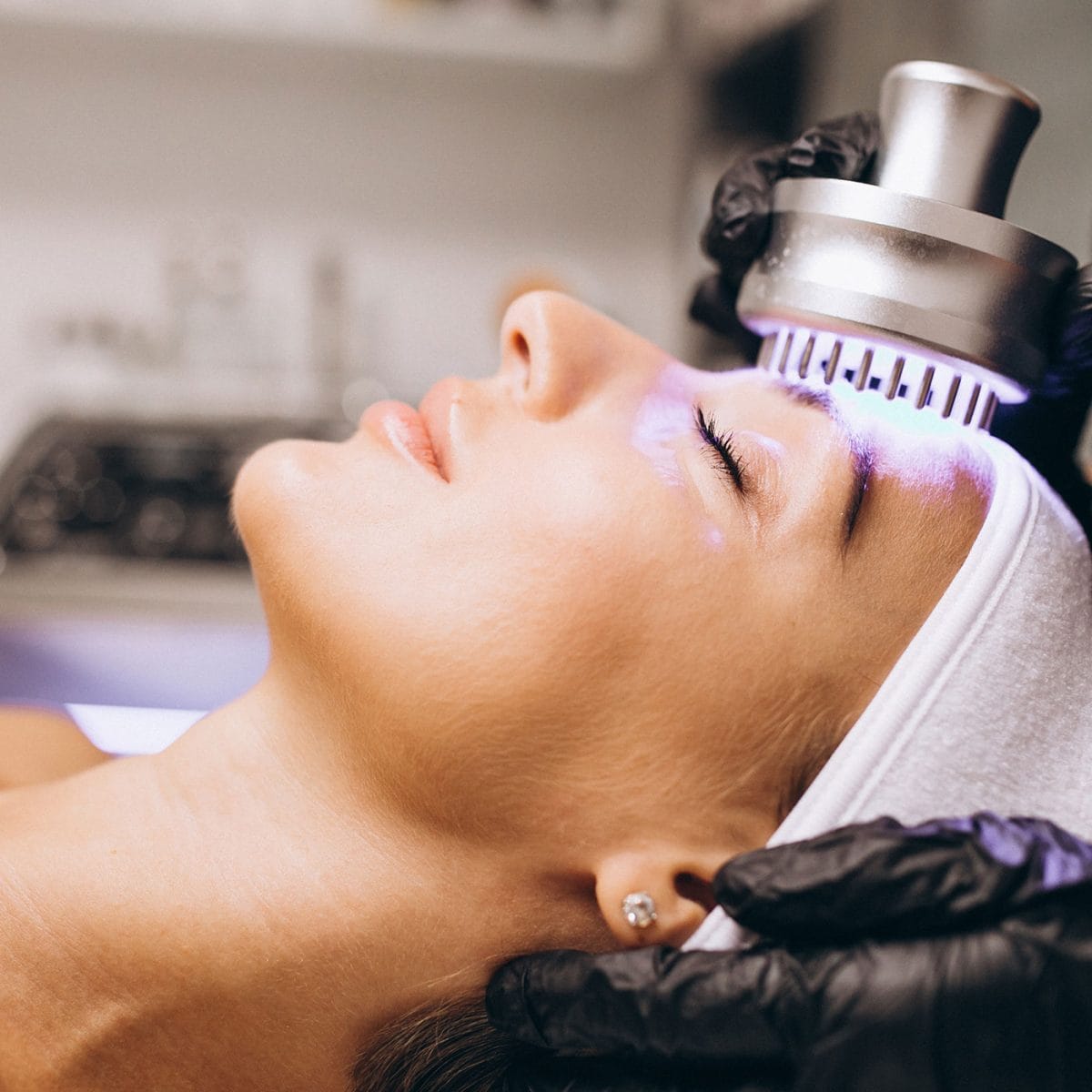 lice žene koja leži zatvorenih očiju tokom laserske procedure u dermatološkoj ordinaciji diva medical u beogradu