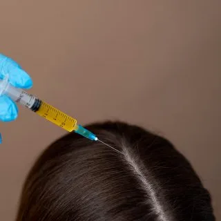 apliciranje hair filera u kosu žene