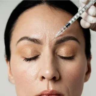 injekcioni tretman protiv bora - aplikacija u predelu između obrva