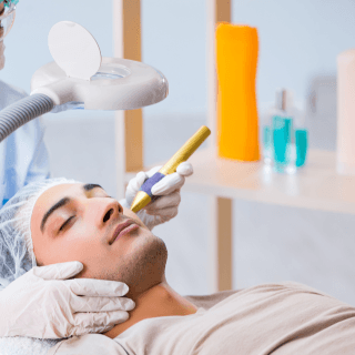 muškarac leži zatvorenih očiju, a pored njegovog lica vide se ruke dermatologa u belim rukavicama - u toku je lasersko uklanja je kapilara sa lica