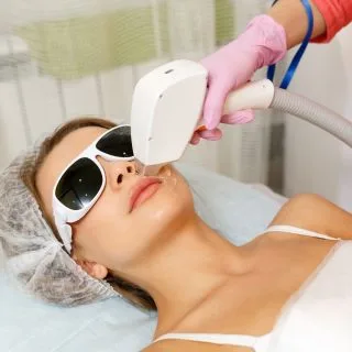 lasersko uklanjanje fleka i hiperpigmentacija u toku - žena leži dok ruka dermatologa u rukavicama drži laser na njenom obrazu