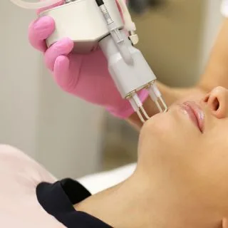 tretman laserskog uklanjanja fleka i hiperpigmentacija u dermatološkoj ordinaciji