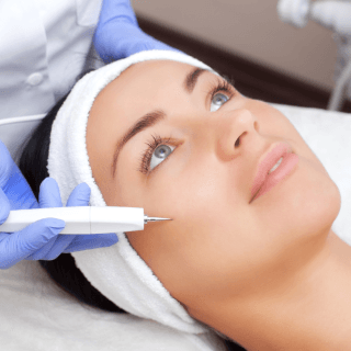 lice žene koja leži na medicinskom stolu u dermatološkoj ordinaciji, pored koga se vide ruke dermatologa u plavim rukavicama - u toku je lasersko lečenje kuperoze