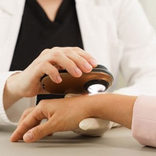 dermoskopija u dermatološkoj ordinaciji u beogradu: dermatolog pregleda dermoskopom kožu na ruci pacijenta
