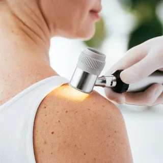 pregled keratoze na ženskom ramenu dermatoskopom u dermatološkoj ordinaciji