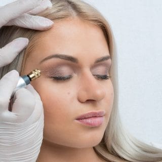 plavokosa žena zatvorenih očiju čiju glavu drže ruke dermatologa u belim rukavicama - u toku su pripreme za neoperativni lifting kapaka