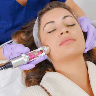 žena leži zatvorenih očiju a dermatolog u plavoj uniformi sa ljubičastim rukavicama drži laser pored njenog lica - u toku je lasersko lečenje akni u dermatološkoj ordinaciji