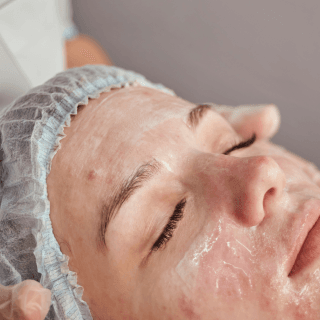 žensko lice koje dermatolog pridržava rukama - u toku je priprema za lasersko lečenje akni