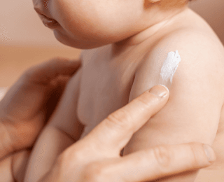 dečiji dermatolog maže kremu na bebino rame