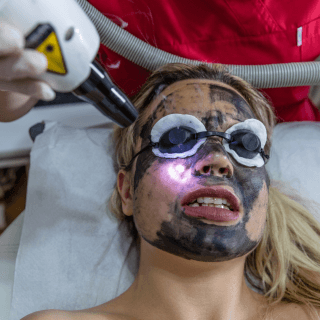 žena na laserskom tretmanu lica u dermatološkoj ordinaciji jer su laserski tretmani odličan izbor kada je u pitanju problematična koža