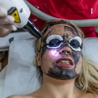 žena na laserskom tretmanu lica u dermatološkoj ordinaciji jer su laserski tretmani odličan izbor kada je u pitanju problematična koža