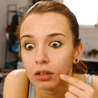 tinejdžerka sa aknama pred ogledalom sa iznenađenim izrazom lica zbog toga što je njena koža problematična koža