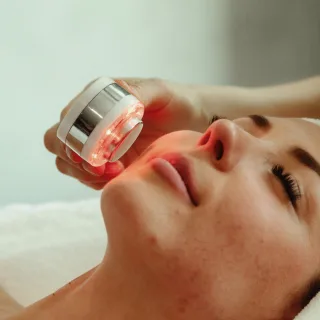 žena leži zatvorenih očiju u dermatološkoj ordinaciji, a ruka dermatologa pored njenog lica drži laser - u toku je laserski tretman za problematičnu kožu
