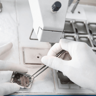 patohistološka analiza nakon uklonjene kožne promene