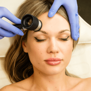 žena leži zatvorenih očiju u dermatološkoj ordinaciji, a dermatolog obavlja pregled mladeža dermoskopom na njenom licu