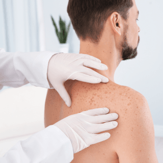 muškarac sedi u dermatološkoj ordinaciji, a dermatolog obavlja pregled mladeža na njegovim leđima; dermatološki pregled prvi je korak koji morate napraviti ako želite uklanjanje mladeža