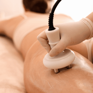 laserska lipoliza nogu