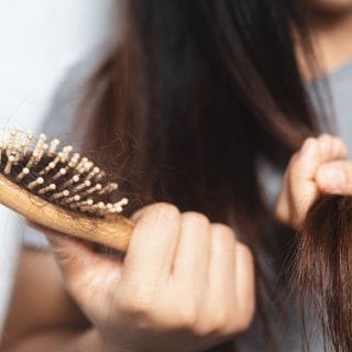 žena drži četku za kosu na kojoj je velika količina opale kose - opadanje kose je problem koji mogu rešiti fileri za kosu